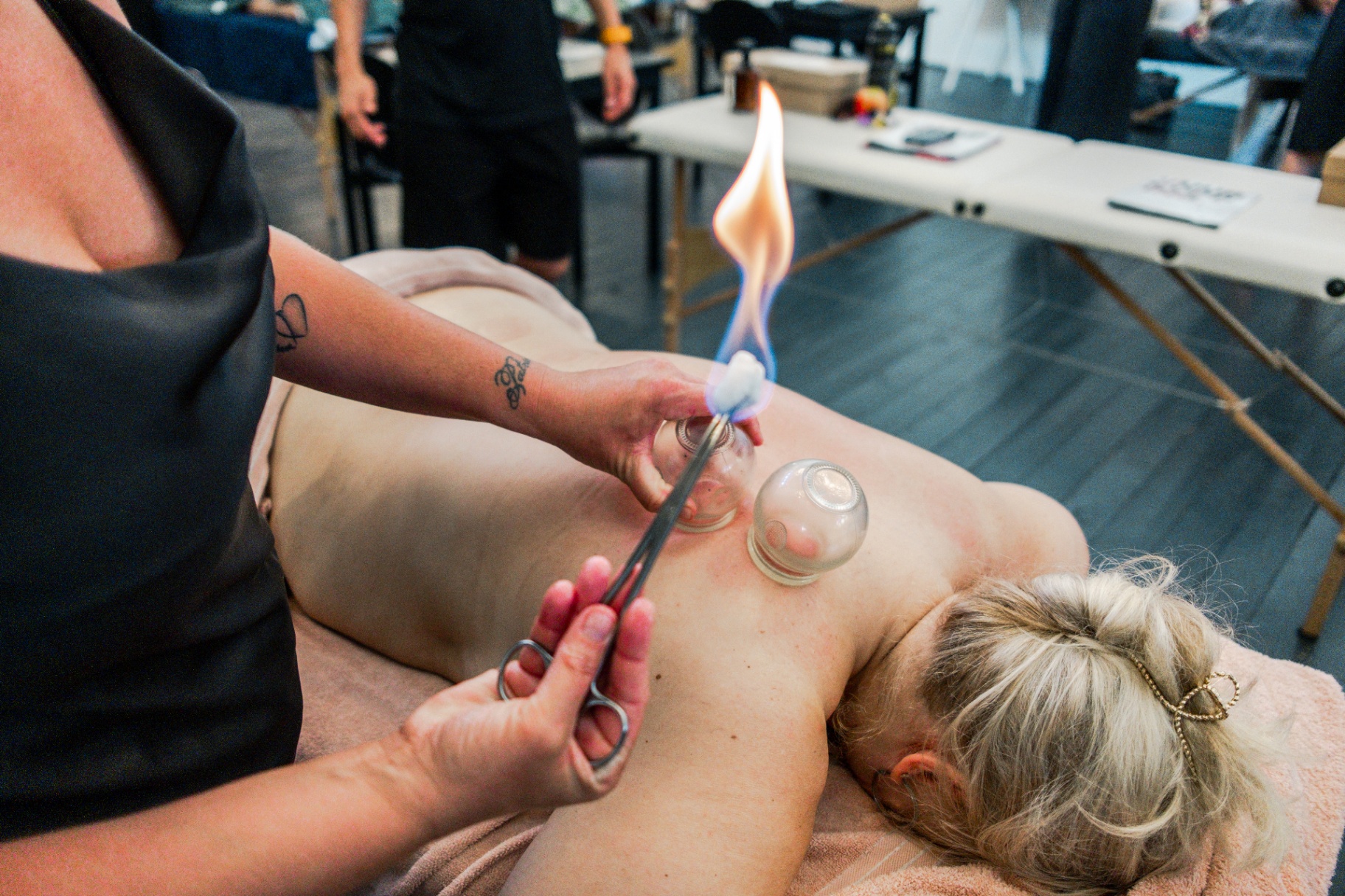 Vuurcupping